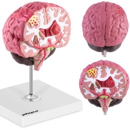 Model anatomiczny 3D mózgu ludzkiego z 3 patologiami skala 1:1 Physa