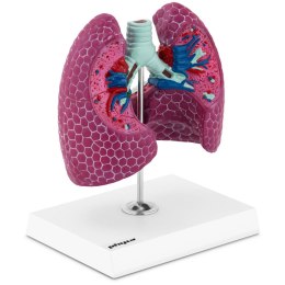 Model anatomiczny 3D płuca człowieka ze zmianami chorobowymi Physa