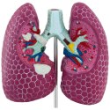 Model anatomiczny 3D płuca człowieka ze zmianami chorobowymi Physa
